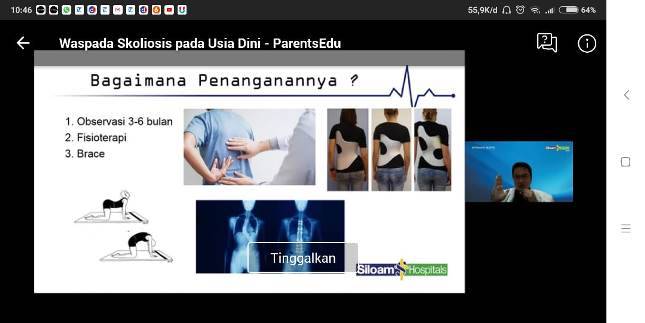 Kondisi Skoliosis Juga Bisa Terjadi pada Usia Remaja