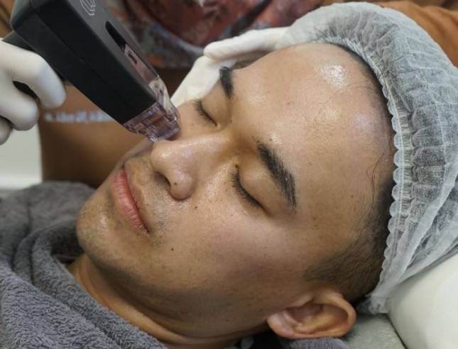 Anwar BAB Tak Mau Kalah Dengan Wanita, Lakukan Treatment Ini Di Klinik Dermapro