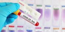 Rapid Test COVID-19 