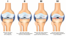 OSTEOARTHRITIS (Foto Ist) 