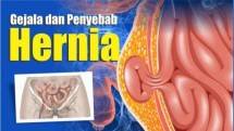 Kenali Seputar Hernia pada Anak, Bisa Disembuhkan