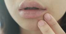Bibir Kering dan Pecah-Pecah? Atasi Dengan Tips Ini