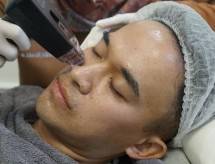 Anwar BAB jalani treatment di Klinik Dermapro Jakarta.