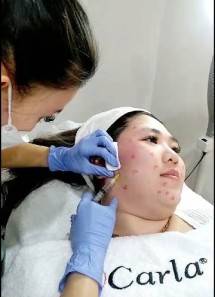 Setelah di Jakarta Barat dan Utara, Carla Skin Clinic siap hadir di Tangerang Selatan